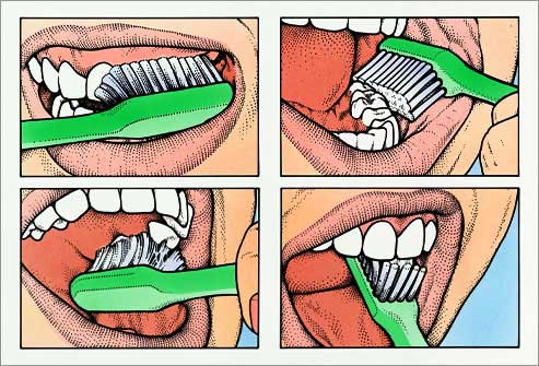 Diagram of teeth brushing