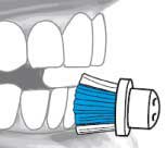 Diagram of Electric Toothbrush